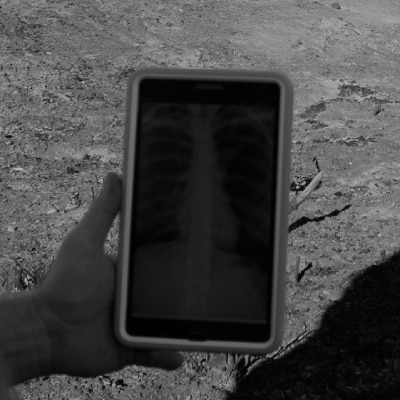 X-RAY