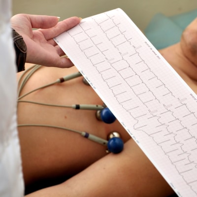 EKG